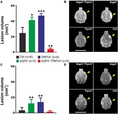 The absence of AQP4/TRPV4 complex substantially reduces acute cytotoxic edema following ischemic injury